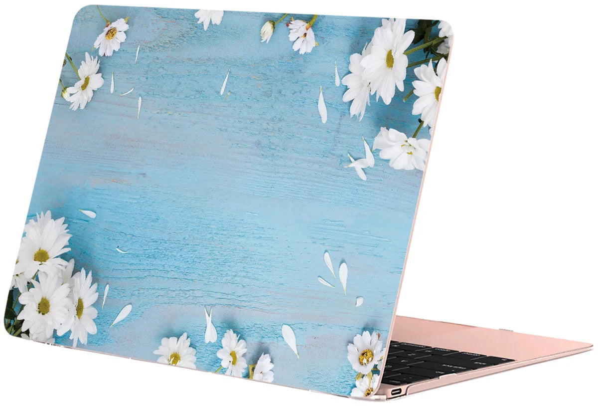 Case for Macbook Air 13 M5 M1 Pro 14 M4 13M3 15 16 M2 Mac Hard Shell Funda Laptop Accessory Cover A3449 A3448 A3427 A3426 Neo 12
