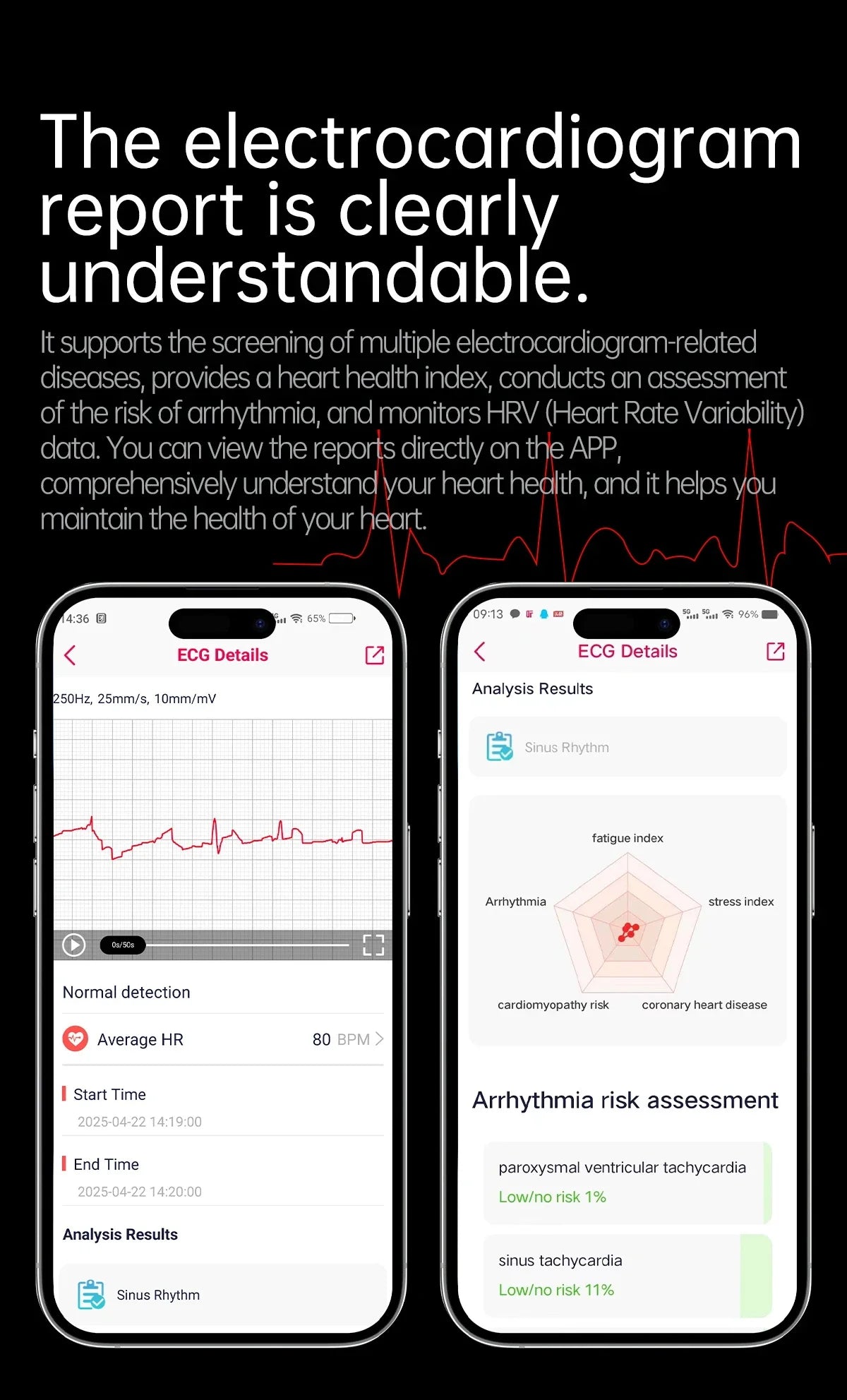 New Nursing Level Blood Pressure Laser Therapy Diagnosis Smart Watch Men Women Clock ECG+PPG Uric Acid Lipid Heart Rate Watches