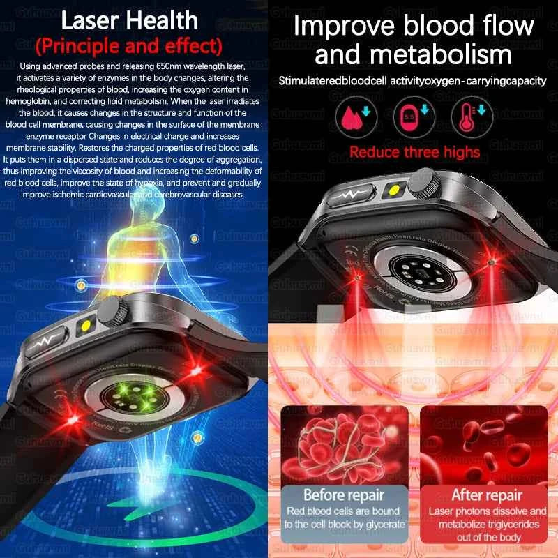 New Laser Treatment Three High Smart Watch Men ECG Heart Rate Uric Acid Health Tracker 1.95 inches Sapphire Glass SmartBracelet